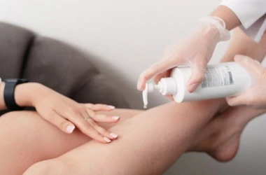 догляд після електроепіляції