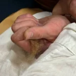 Звірство під мурами Києва: п’яний підліток вирвав жмут волосся у фельдшерки “швидкої”, яка приїхала на виклик