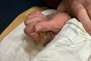 Звірство під мурами Києва: п'яний підліток вирвав жмут волосся у фельдшерки "швидкої", яка приїхала на виклик
